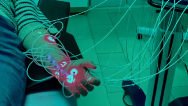 Behandeling van carpaaltunnel syndroom met fotobiomodulatie