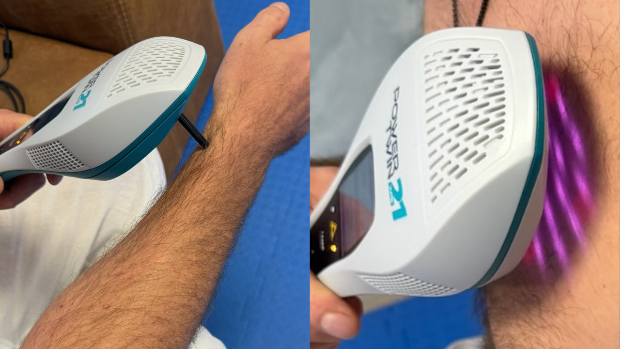 Acupunctuur en fotobiomodulatie met PowerTwin21 XP5